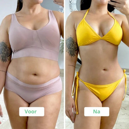 CelluFix – Vermindert cellulite, verstevigt huid en modelleert je figuur