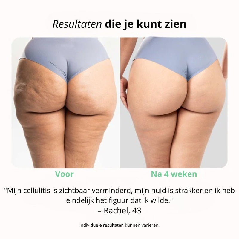 CelluFix – Vermindert cellulite, verstevigt huid en modelleert je figuur